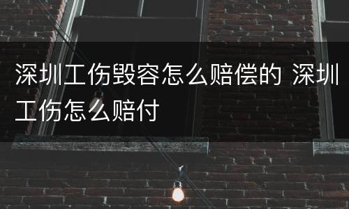 深圳工伤毁容怎么赔偿的 深圳工伤怎么赔付